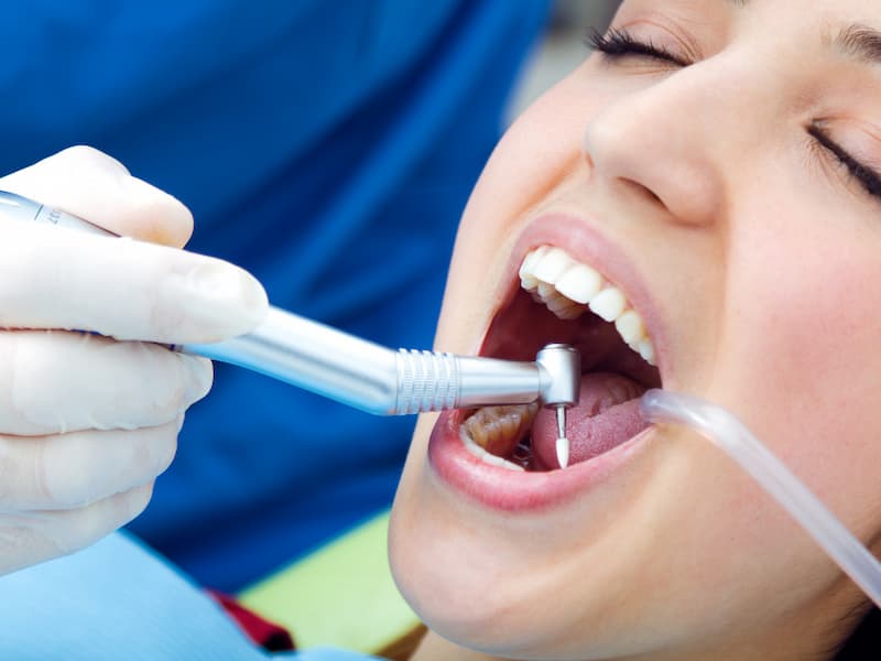Tooth Extraction service