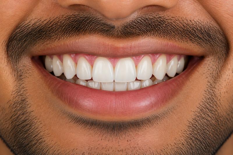 dental-implant-after-treatment