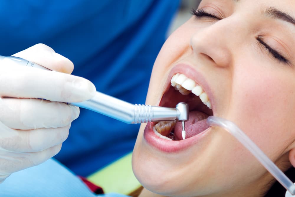 Benefits of Dental Fillings - are Dental Fillings Right for You?