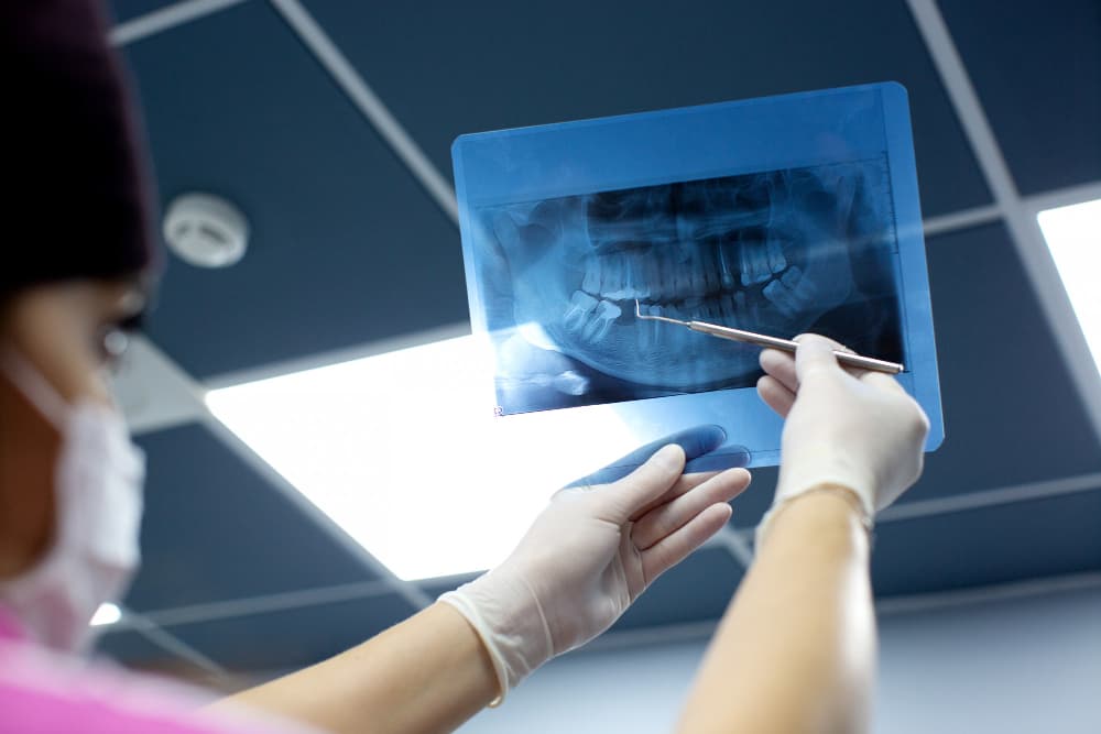 choose dental x ray Why Choose Dental X-Rays in Lucknow?