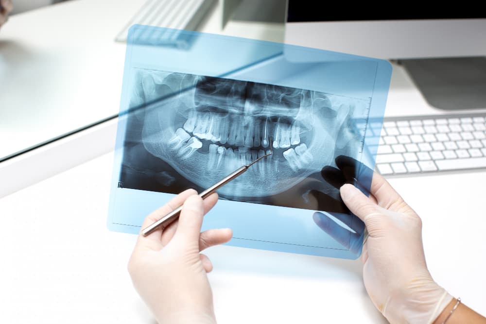 what we do x ray what we do x ray